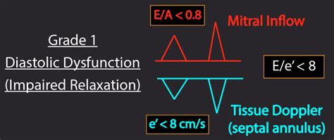 diastolic dysfunction grade 1 exercise.